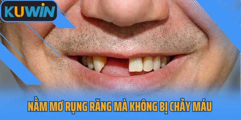Nằm mơ rụng răng mà không bị chảy máu có tốt không?